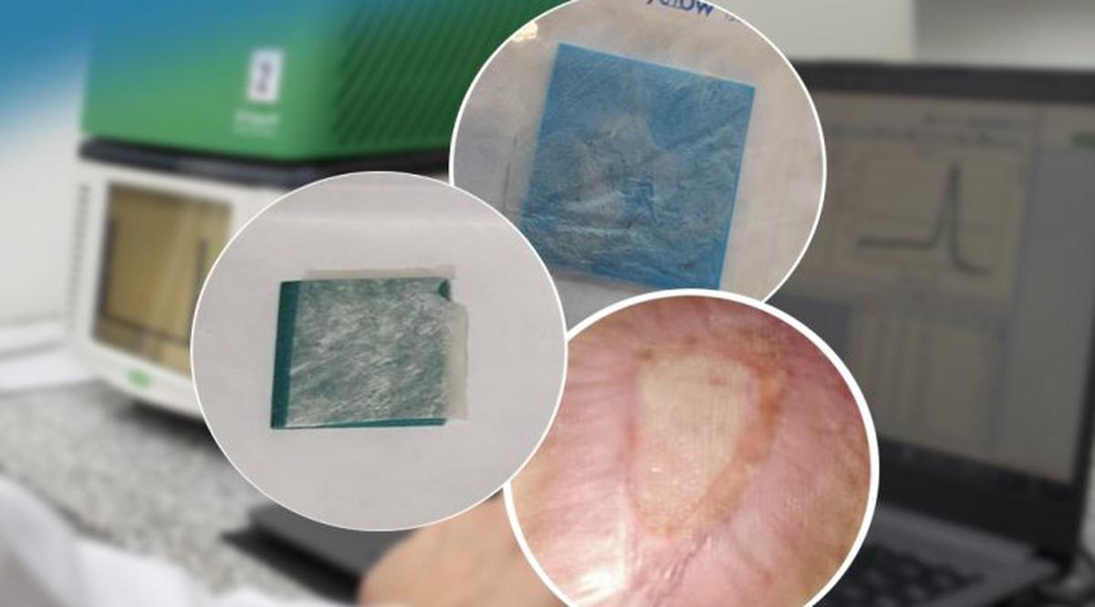 Un equipo de Cirugía del CEMIC participa en un avance innovador para el tratamiento de heridas complejas